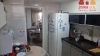 Foto 10 de Apartamento com 3 Quartos à venda, 93m² em Jardim São Paulo, João Pessoa