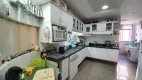 Foto 11 de Apartamento com 4 Quartos à venda, 150m² em Aldeota, Fortaleza