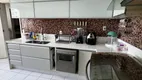 Foto 28 de Apartamento com 3 Quartos à venda, 170m² em Imbiribeira, Recife