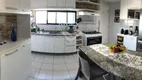 Foto 15 de Apartamento com 3 Quartos à venda, 128m² em Parnamirim, Recife
