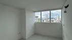 Foto 28 de Apartamento com 4 Quartos para alugar, 100m² em Mauricio de Nassau, Caruaru