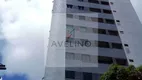 Foto 8 de Apartamento com 2 Quartos para alugar, 48m² em Torre, Recife