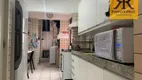 Foto 24 de Apartamento com 3 Quartos à venda, 115m² em Madalena, Recife