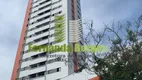 Foto 2 de Apartamento com 3 Quartos à venda, 107m² em Tamarineira, Recife